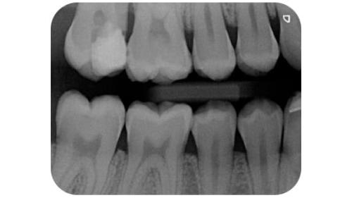 VistaScan Ultra Bildqualitaet-1